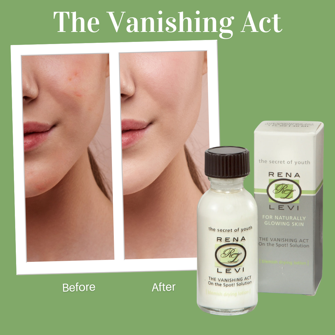 On the Spot! Acne Emergency Solution
