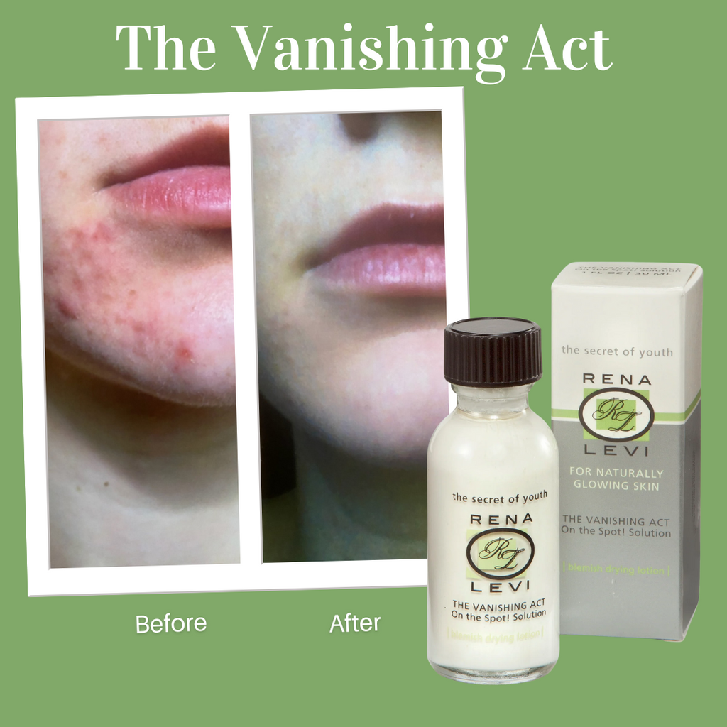 On the Spot! Acne Emergency Solution