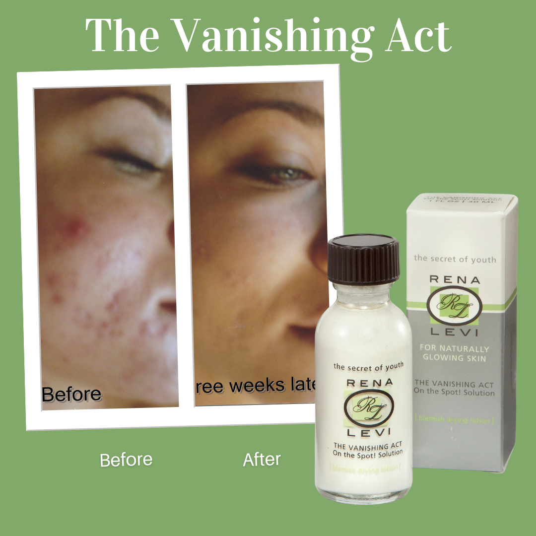 On the Spot! Acne Emergency Solution
