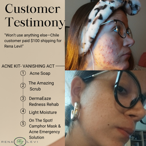 DermaEaze Redness Rehab: Soothe and Revitalize Your Skin