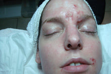 Load image into Gallery viewer, Rena Levi’s Deep Herbal Peel Kit   (PRO)