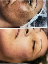 Load image into Gallery viewer, Rena Levi’s Deep Herbal Peel Kit   (PRO)