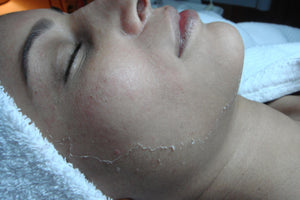 Rena Levi’s Deep Herbal Peel   (PROFESSIONAL USE ONLY)